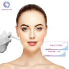 Cosmetic Grade Injectable Hyaluronic Acid Dermal Fillers For Lip