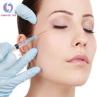 Safety Injectable Lip Wrinkle Filler Non Surgical Lip Augmentation