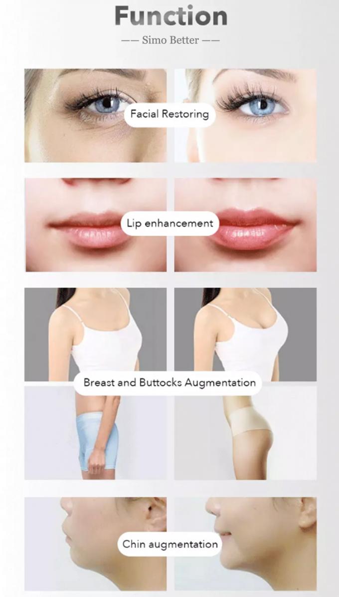Sodium Hyaluronate Injectable Dermal Fillers Non Surgical Lip Enhancement Gel