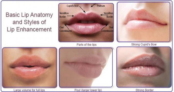 Male Female Lip Injection Plumper Nasolabial Fold Natural Looking Lip Fillers